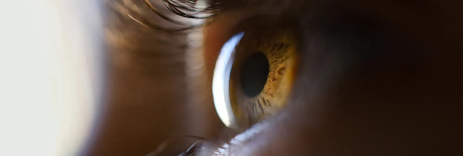 VISION